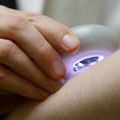 Skin exam