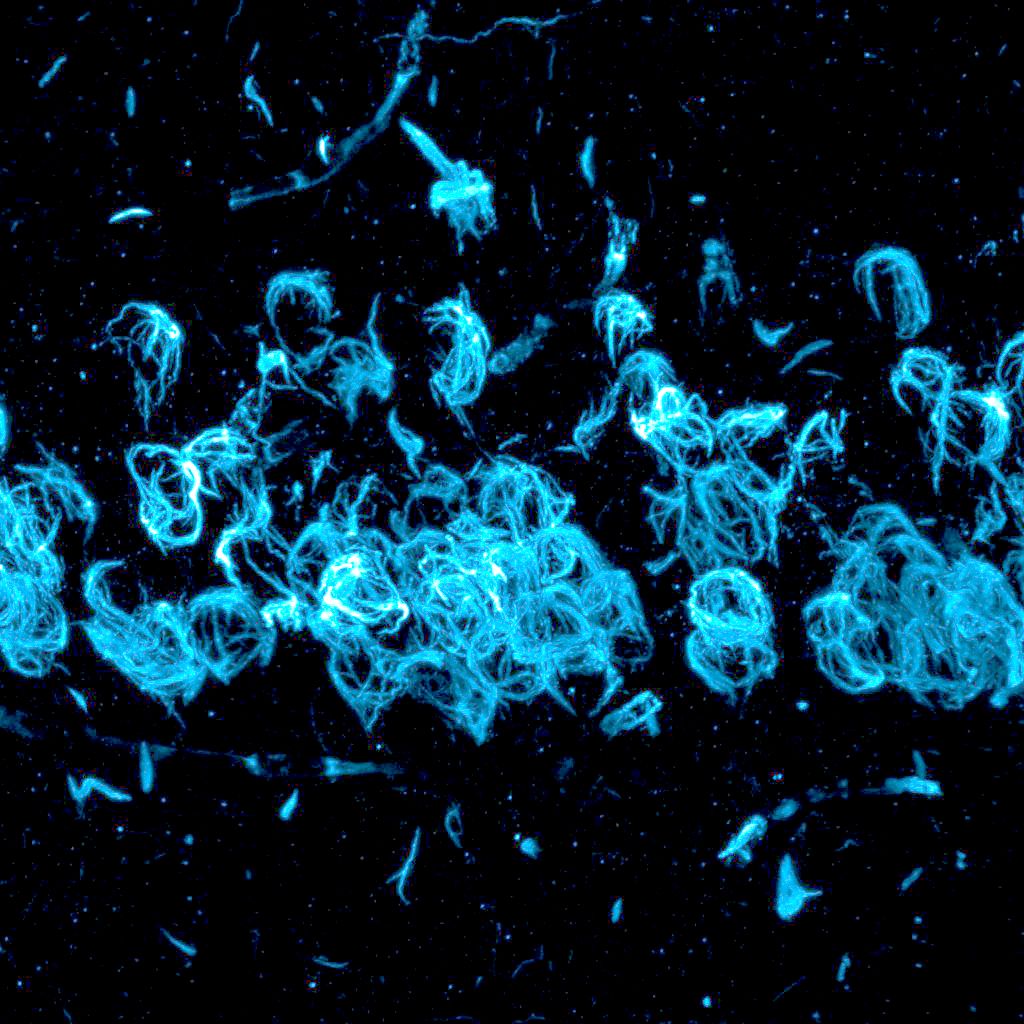 a microscope image showing light blue swirls across a black screen
