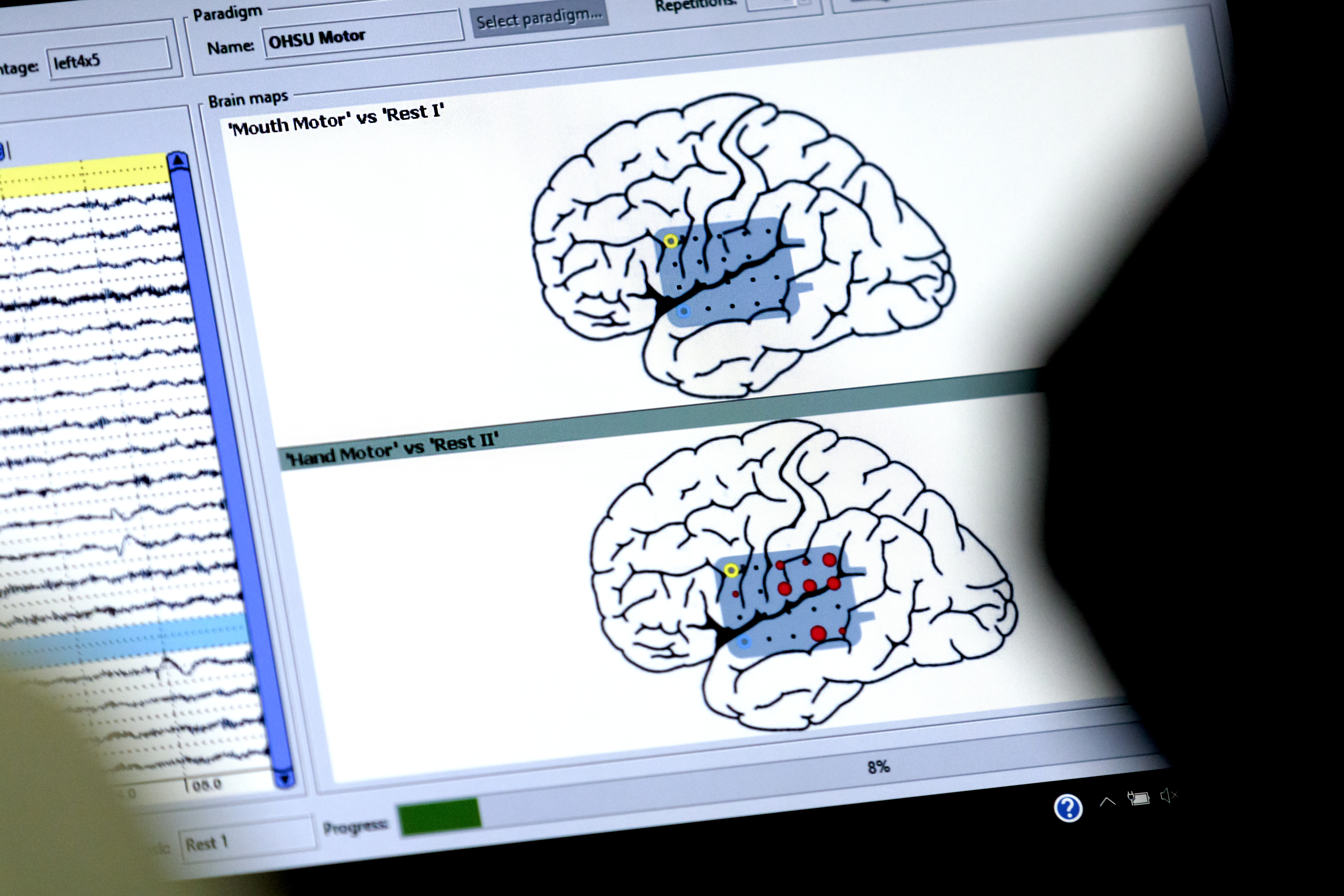 computer screen showing outline of two brains with highlighted areas showing where areas of cognition are