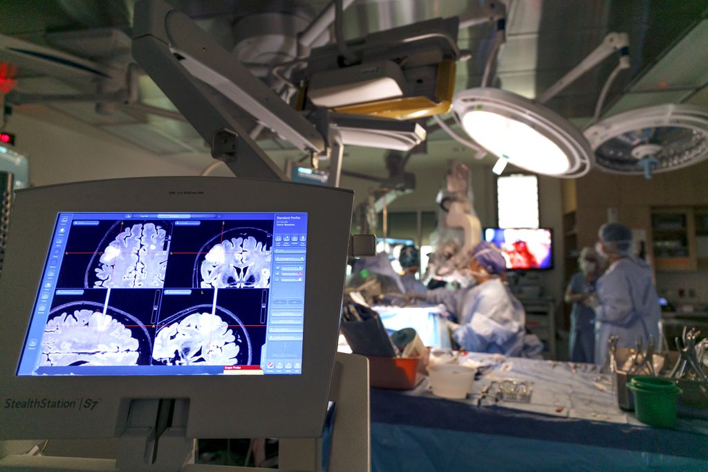 computer monitor shows black/white image of a brain with a tumor on left side of image, with surgery table in background, blurry on right side of the picture