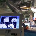 Awake craniotomy with language mapping