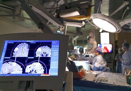 Awake craniotomy with language mapping