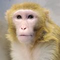 Bardet-Biedl syndrome