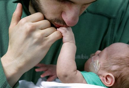 Retinopathy of prematurity (ROP)