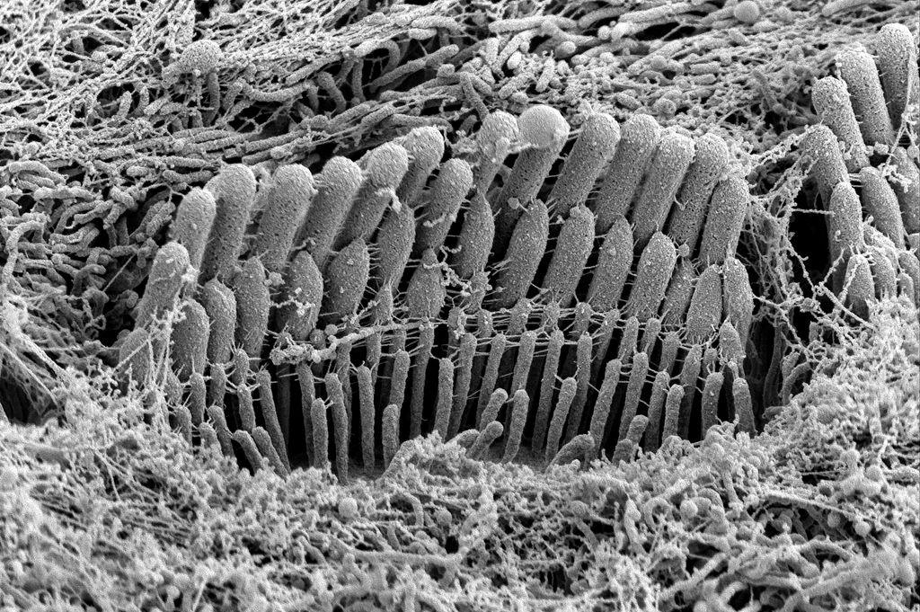 black and white image showing large tubular protrusions growing