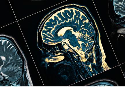 Brain imaging