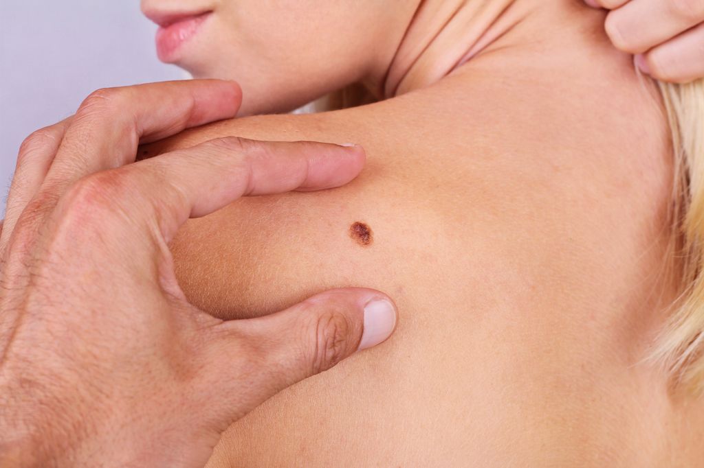woman looking over her bare shoulder as a man's hand frames up a large mole