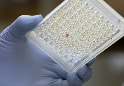 COVID-19 antibody testing