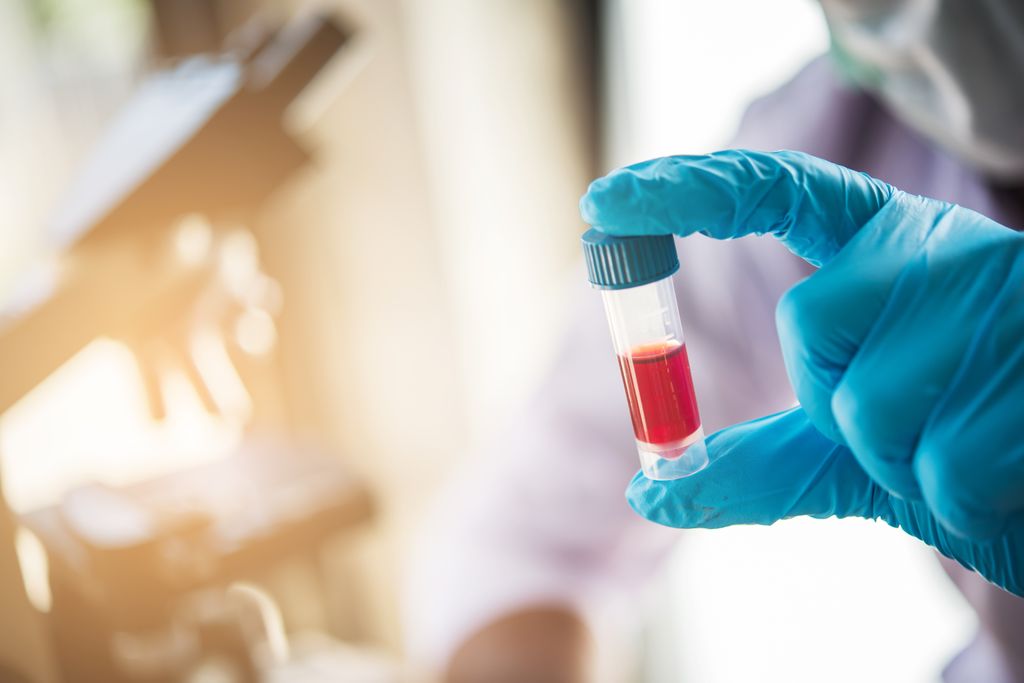 hand holding a testtube of red liquid with a microscope in background