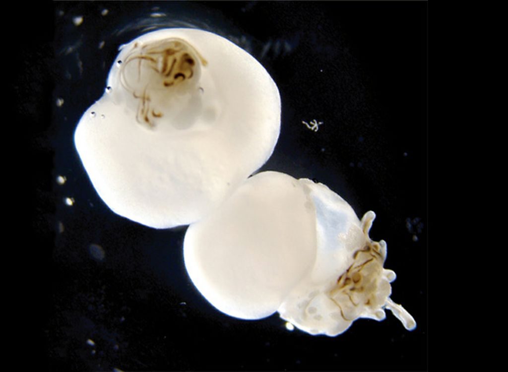 big white globules with a hair coming out