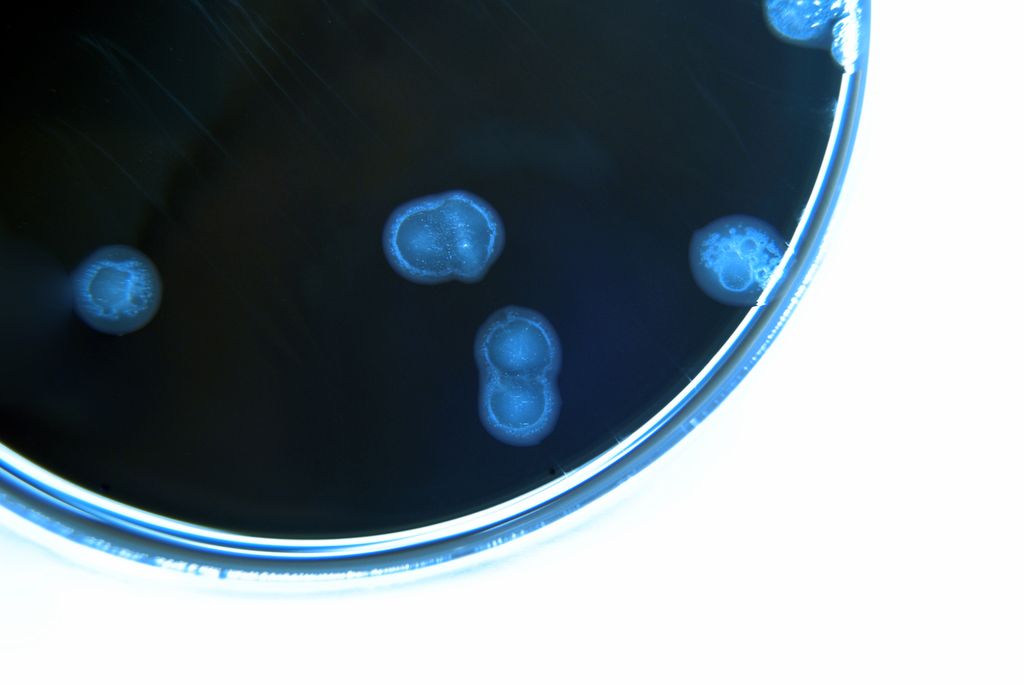 a petri dish, tinted blue, with circles of campylobacter bacteria