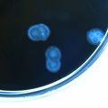 New vaccine holds promise in fighting diarrheal disease