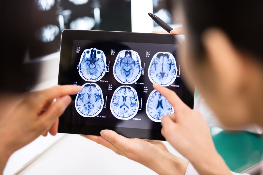 over shoulder of two men looking at xrays of brain on a digital tablet