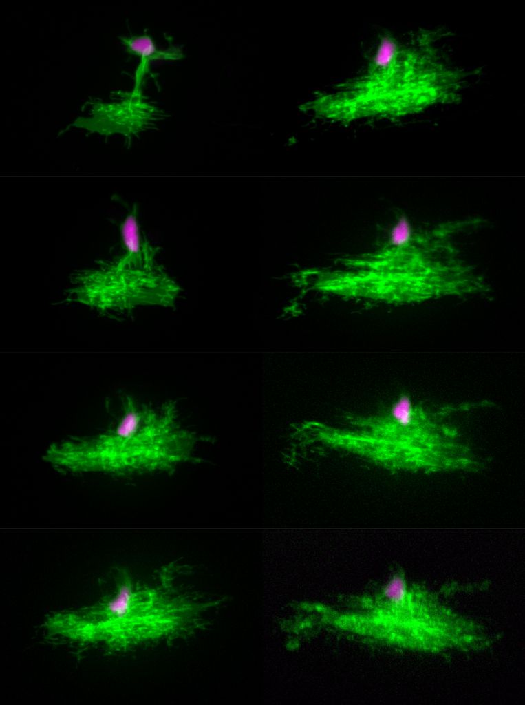green glowing blobs on a black background, with the astrocyte noted in pink 