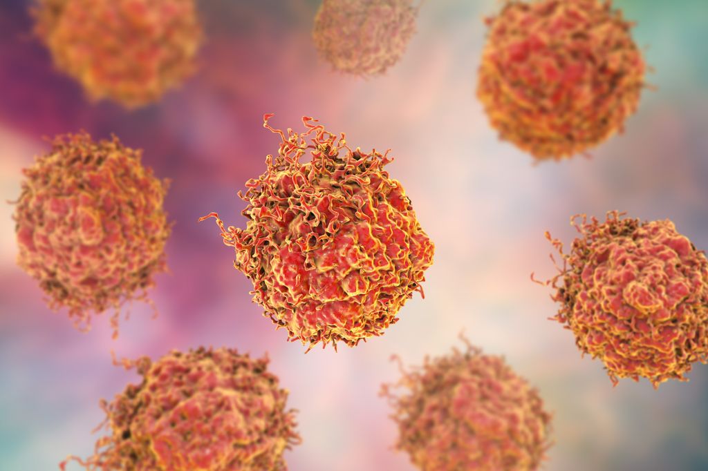 Prostate cancer cells, 3D illustration. Prostate cancer awareness image
