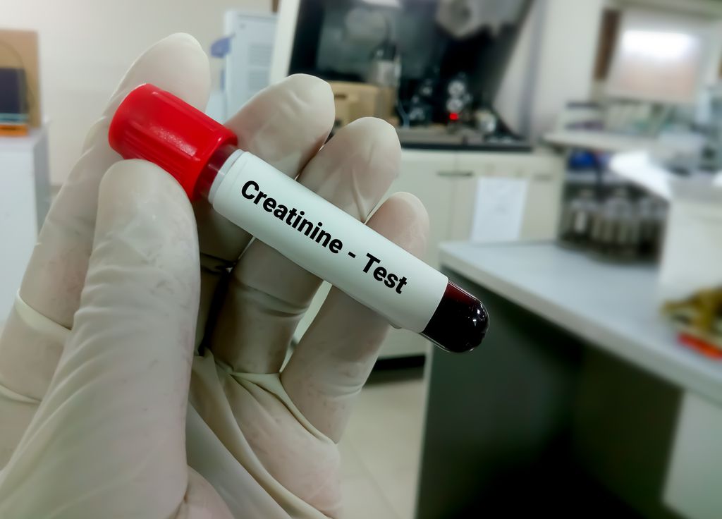 OHSU ends practice of factoring a patients race into treatment decisions in kidney disease. Image is of a vial of blood to be used to test kidney disease.