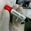 OHSU ends practice of factoring a patients race into treatment decisions in kidney disease