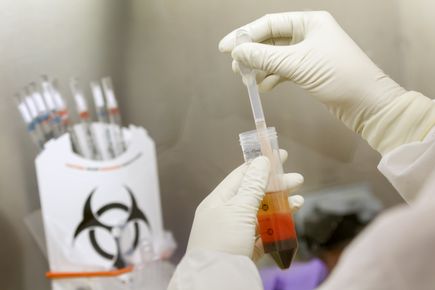 OHSU investigators awarded 3 million for innovative promising research