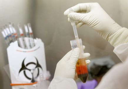 OHSU investigators awarded 3 million for innovative promising research