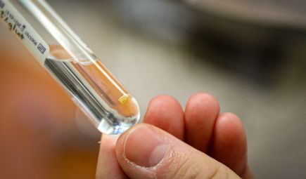 Clitoris nerve tissue sample