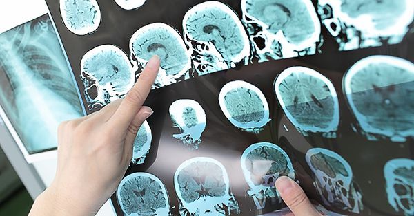 Brain imaging picture.
