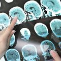 New OHSU Science Café series focuses on neuroscience research 