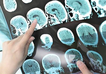 New OHSU Science Café series focuses on neuroscience research 