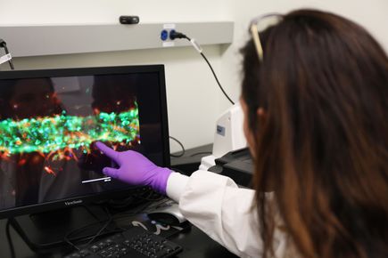 New research helps explain how inflammation increases COVID-19 vulnerability