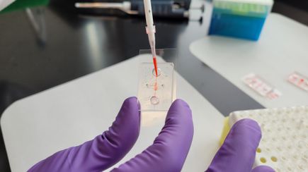 New research helps explain how inflammation increases COVID-19 vulnerability
