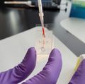 New research helps explain how inflammation increases COVID-19 vulnerability