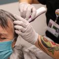 New treatment for tremors: Cutting-edge brain surgery with no cutting