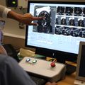 New treatment for tremors: Cutting-edge brain surgery with no cutting