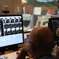 New treatment for tremors: Cutting-edge brain surgery with no cutting