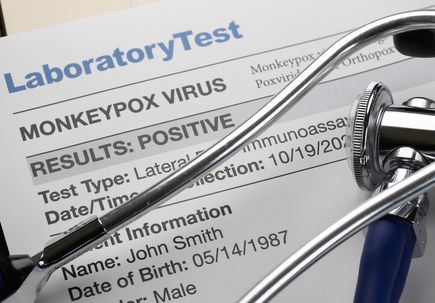 Mpox (monkeypox): OHSU expert advises vigilance, not alarm 