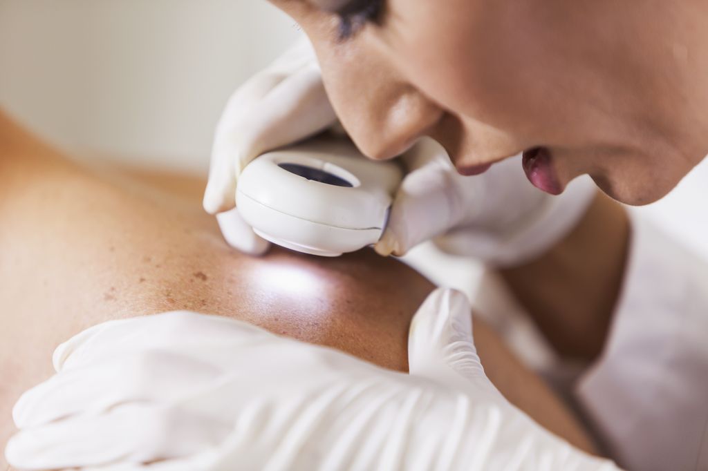 A doctor looks closely at a person's back skin during a skin cancer check.