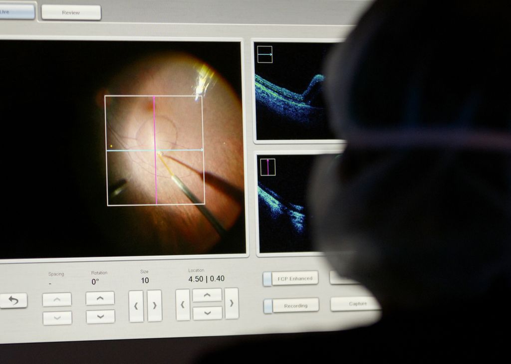 Oregon Health & Science University’s Casey Eye Institute clinicians provide Luxturna, an FDA-approved gene therapy to correct blindness-causing mutations to the RPE65 gene, during a Sept. 17, 2018, surgery. Today, OHSU and Oregon State University researchers are developing a new approach to gene therapy that uses lipid nanoparticles to deliver messenger ribonucleic acid, or mRNA, inside the eye.&nbsp;(OHSU/Kristyna Wentz-Graff)