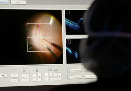 Nanotechnology may improve gene therapy for blindness