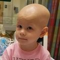 New drug to prevent hearing loss in children with cancer
