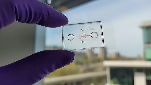 Research helps explain how inflammation increases COVID-19 vulnerability