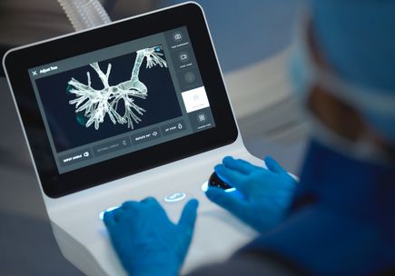 OHSU incorpora nuevas herramientas a la lucha contra el cáncer de pulmón