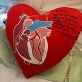 New mom had torn aorta