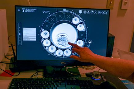 Studying primate embryos to advance human health
