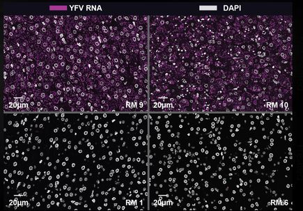 Lab-made antibodies offer potential cure for yellow fever 