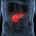 Pancreatic cancer detection