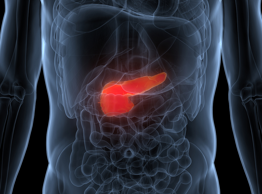 Oregon Health & Science University researchers' innovative approach to early cancer detection&nbsp;earned them&nbsp;a $3.8 million grant and they were made a member of the National Cancer Institute’s Pancreatic Cancer Detection Consortium. (Getty Images)