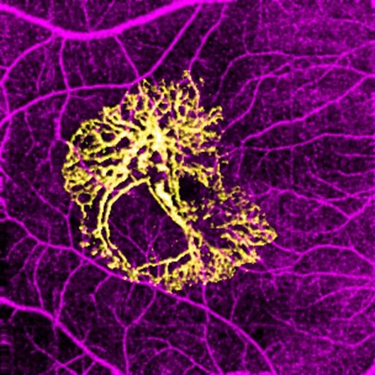 Optical coherence tomography angiography