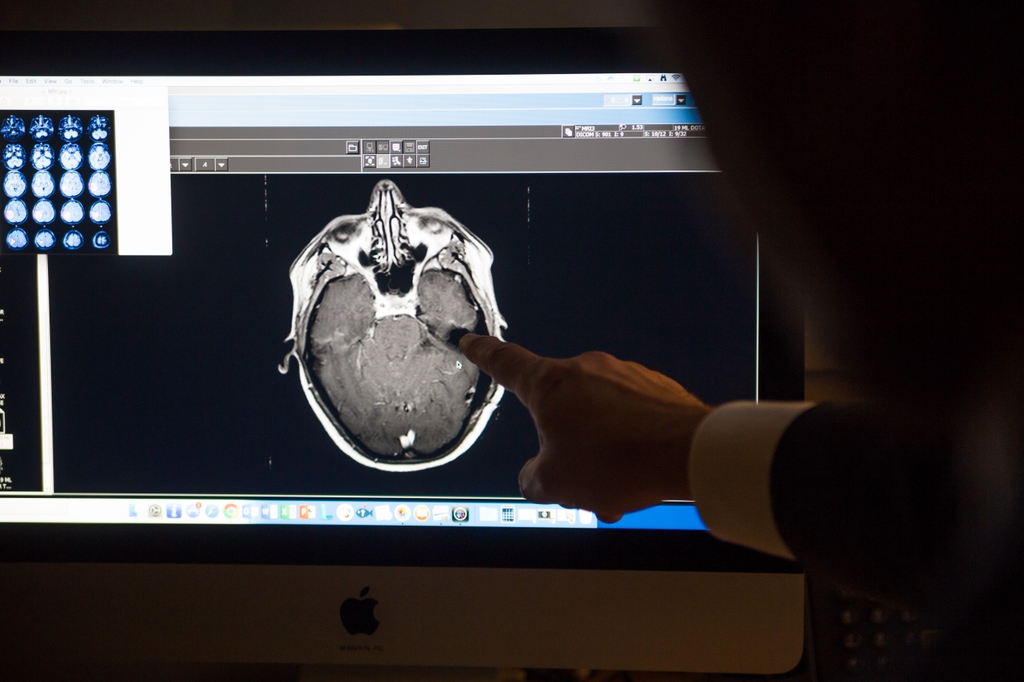Fentanyl brain research: Image shows a doctor pointing to a computer screen that is displaying an x-ray scan of a human brain. An Oregon Health & Science University patient was the first documented case of illicit fentanyl inhalation causing toxic leukoencephalopathy, where large sections of white matter in his brain became inflamed to the point that he had lost consciousness and risked irreversible loss of brain function, or possibly death. (OHSU)