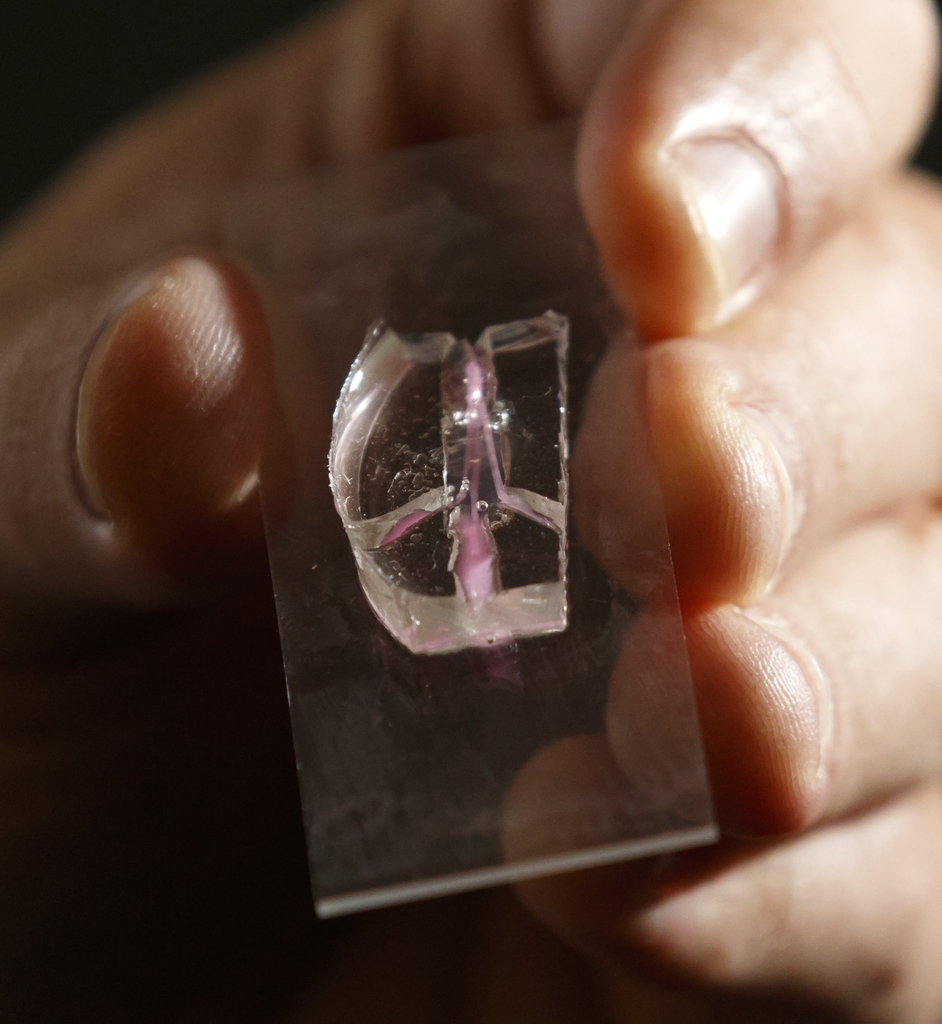 Artificial blood vessels