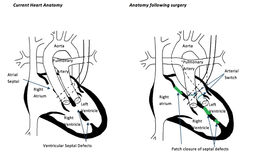 Heart diagram