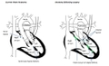 Heart diagram